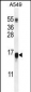 WFDC12 Antibody (C-term)